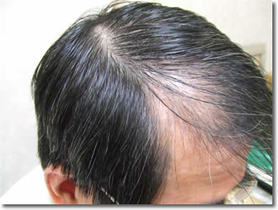 「頭髪実験」2006年12月-1
