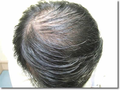 「頭髪実験」2006年12月-2