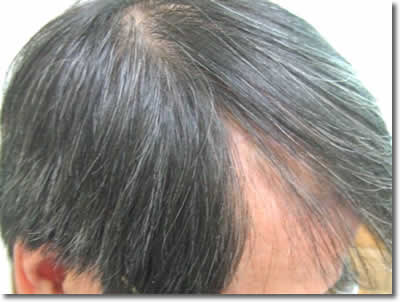 「頭髪実験」2007年2月-2