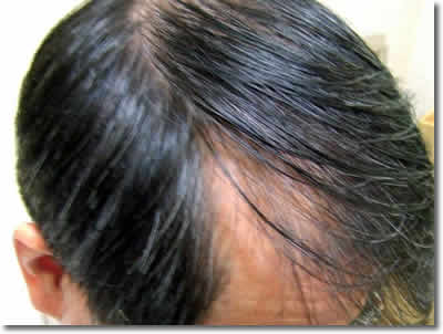 「頭髪実験」2007年6月-2