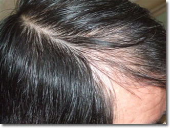 「頭髪実験」2006年1月-1