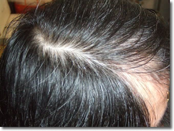 「頭髪実験」2006年2月-1