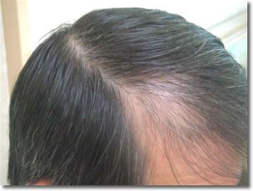 「頭髪実験」2006年4月-1