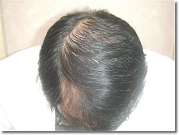 「頭髪実験」2006年4月-2