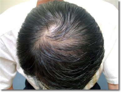 「頭髪実験」2006年9月-1