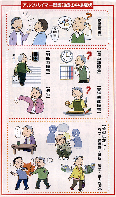アルツハイマー型認知症イラスト