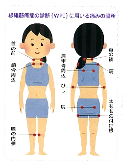 繊維繊維　イラスト