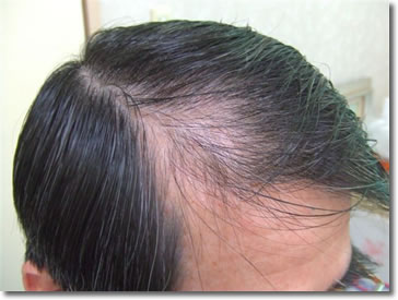「頭髪実験」2006年5月-1