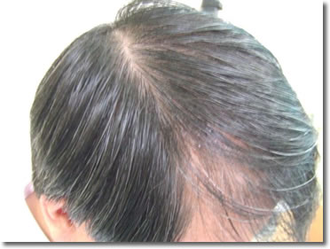 「頭髪実験」2006年6月-1