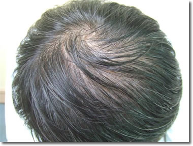 「頭髪実験」2006年8月-1