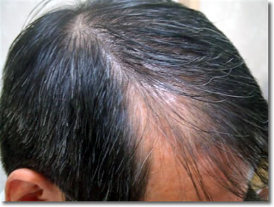 「頭髪実験」2006年9月-2